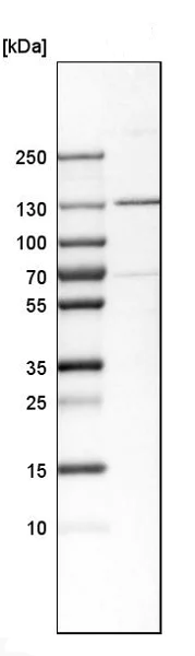 Western blot - Anti-TYK2 antibody (AB223733)