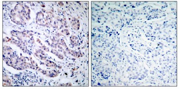 Immunohistochemistry (Formalin/PFA-fixed paraffin-embedded sections) - Anti-TYK2 antibody (AB39550), expandable thumbnail