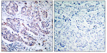Immunohistochemistry (Formalin/PFA-fixed paraffin-embedded sections) - Anti-TYK2 antibody (AB39550)