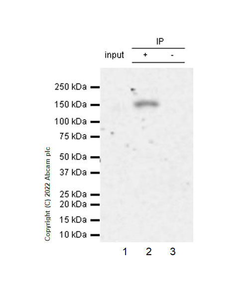 Immunoprecipitation - Anti-TYK2 antibody [EPR24628-106] (AB303500)