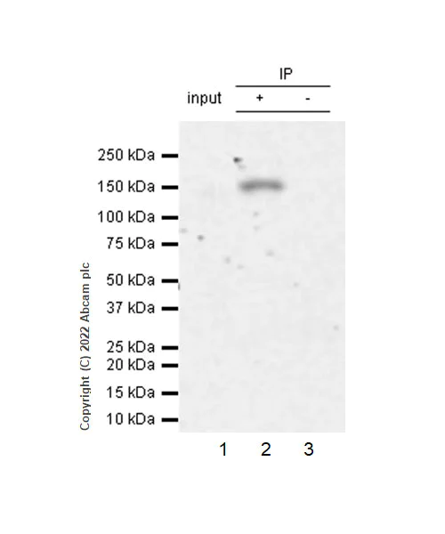 Immunoprecipitation - Anti-TYK2 antibody [EPR24628-106] (AB303500)