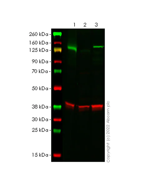 Western blot - Anti-TYK2 antibody [EPR24628-106] (AB303500)