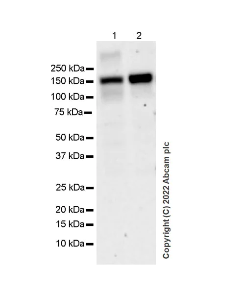 Western blot - Anti-TYK2 antibody [EPR24628-106] (AB303500)