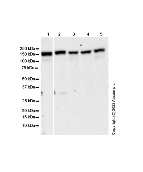 Western blot - Anti-TYK2 antibody [EPR24628-106] (AB303500)
