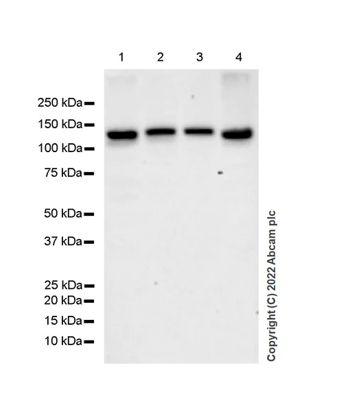 Western blot - Anti-TYK2 antibody [EPR24628-106] (AB303500)