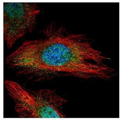 Immunocytochemistry/ Immunofluorescence - Anti-TYK2 antibody - N-terminal (AB227190)