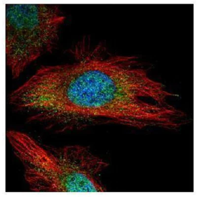 Immunocytochemistry/ Immunofluorescence - Anti-TYK2 antibody - N-terminal (AB227190)