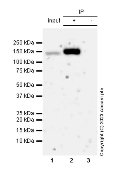 Immunoprecipitation - Anti-TYK2 (phospho Y1054 + Y1055) antibody [EPR28591-25] (AB314878)