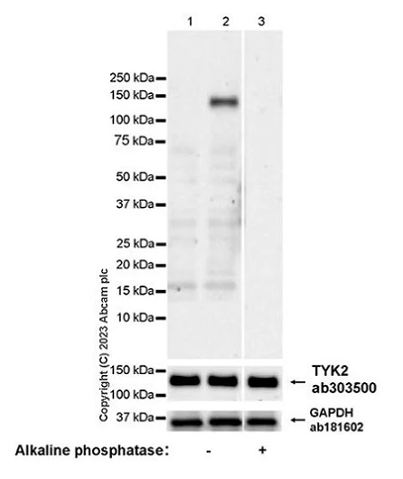 Western blot - Anti-TYK2 (phospho Y1054 + Y1055) antibody [EPR28591-25] (AB314878)