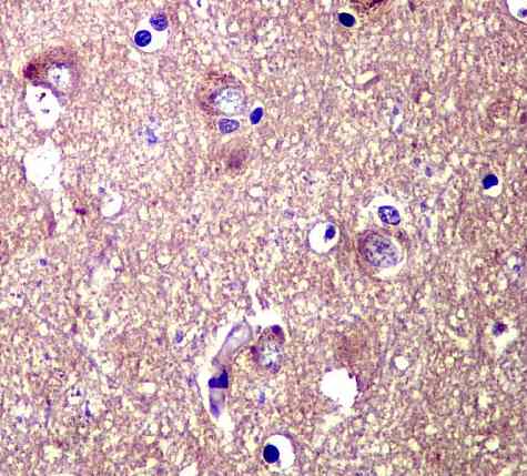Immunohistochemistry (Formalin/PFA-fixed paraffin-embedded sections) - Anti-TYRO3 antibody [EPR4308] - BSA and Azide free (AB235078), expandable thumbnail