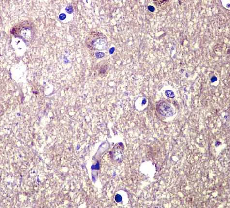 Immunohistochemistry (Formalin/PFA-fixed paraffin-embedded sections) - Anti-TYRO3 antibody [EPR4308] - BSA and Azide free (AB235078)