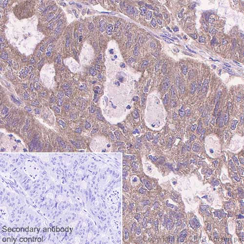 Immunohistochemistry (Formalin/PFA-fixed paraffin-embedded sections) - Anti-TYRO3 antibody [EPR4308] - BSA and Azide free (AB235078), expandable thumbnail