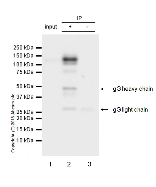 Immunoprecipitation - Anti-TYRO3 antibody [EPR4308] - BSA and Azide free (AB235078)