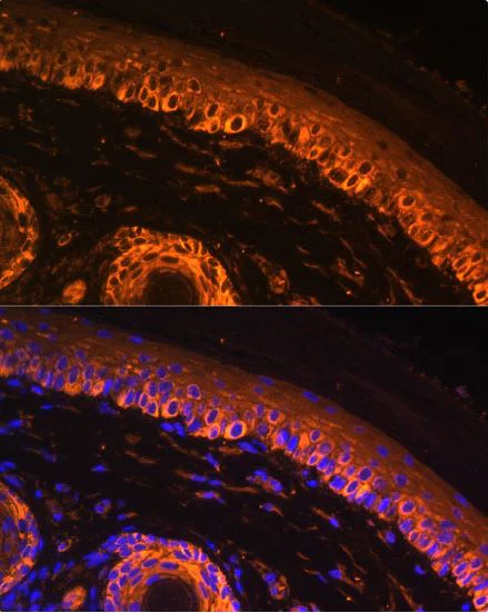 Immunocytochemistry/ Immunofluorescence - Anti-Tyrosinase antibody (AB180753)