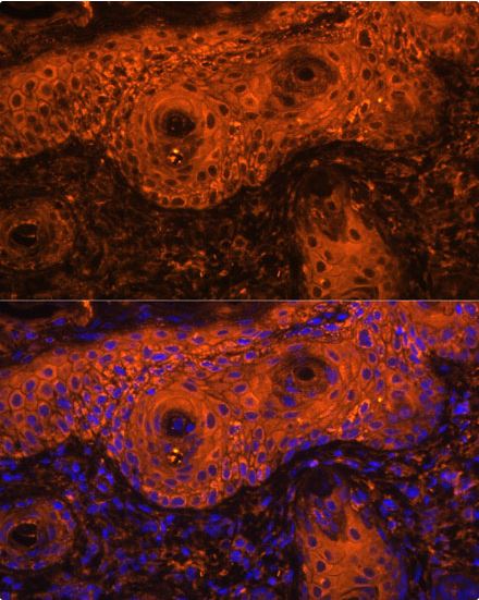 Immunocytochemistry/ Immunofluorescence - Anti-Tyrosinase antibody (AB180753)