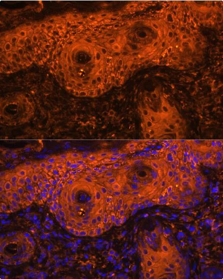 Immunocytochemistry/ Immunofluorescence - Anti-Tyrosinase antibody (AB180753)