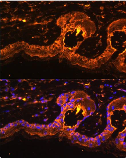 Immunocytochemistry/ Immunofluorescence - Anti-Tyrosinase antibody (AB180753)