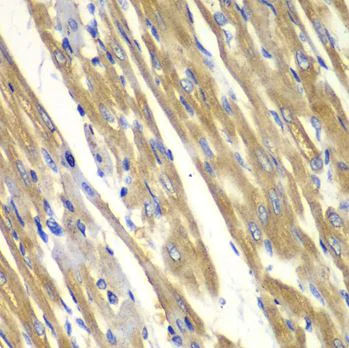 Immunohistochemistry (Formalin/PFA-fixed paraffin-embedded sections) - Anti-Tyrosinase antibody (AB180753)