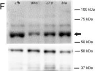 Western blot - Anti-Tyrosinase antibody (AB180753)