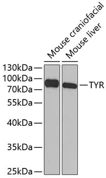 Western blot - Anti-Tyrosinase antibody (AB180753)