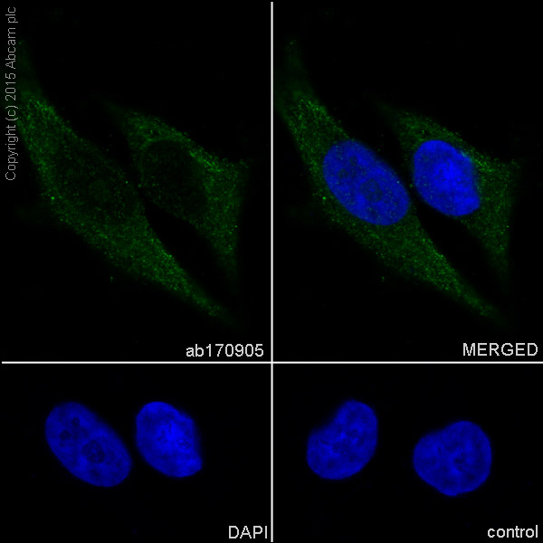 Immunocytochemistry/ Immunofluorescence - Anti-Tyrosinase antibody [EPR10141] (AB170905), expandable thumbnail