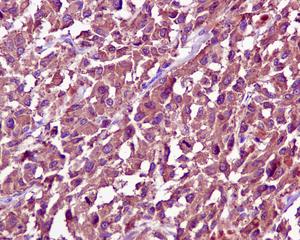 Immunohistochemistry (Formalin/PFA-fixed paraffin-embedded sections) - Anti-Tyrosinase antibody [EPR10141] (AB170905), expandable thumbnail