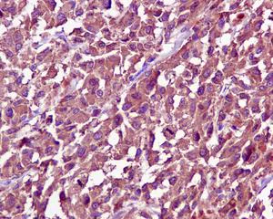Immunohistochemistry (Formalin/PFA-fixed paraffin-embedded sections) - Anti-Tyrosinase antibody [EPR10141] (AB170905)