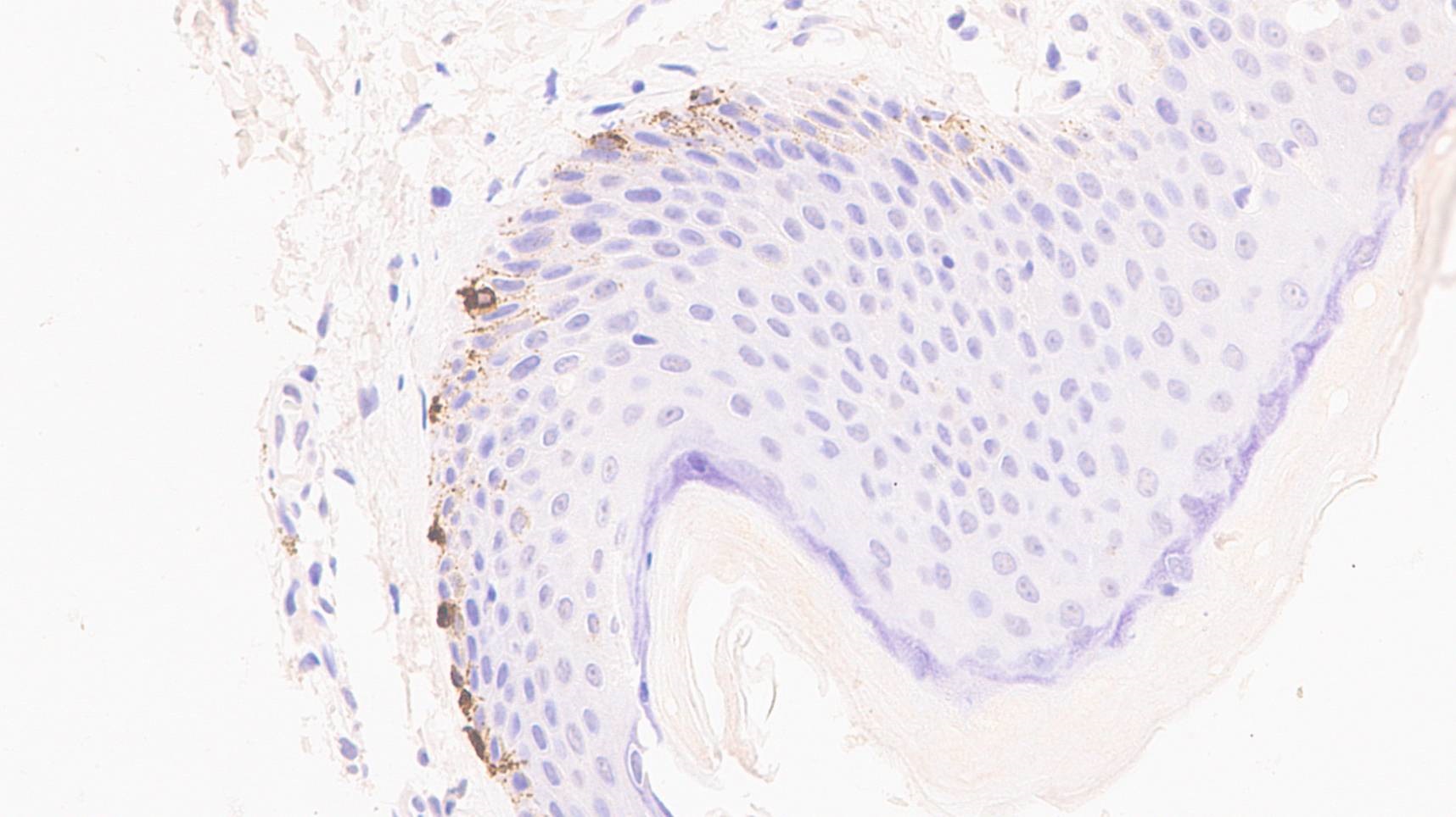 Immunohistochemistry (Formalin/PFA-fixed paraffin-embedded sections) - Anti-Tyrosinase antibody [EPR10141] (ab170905), expandable thumbnail