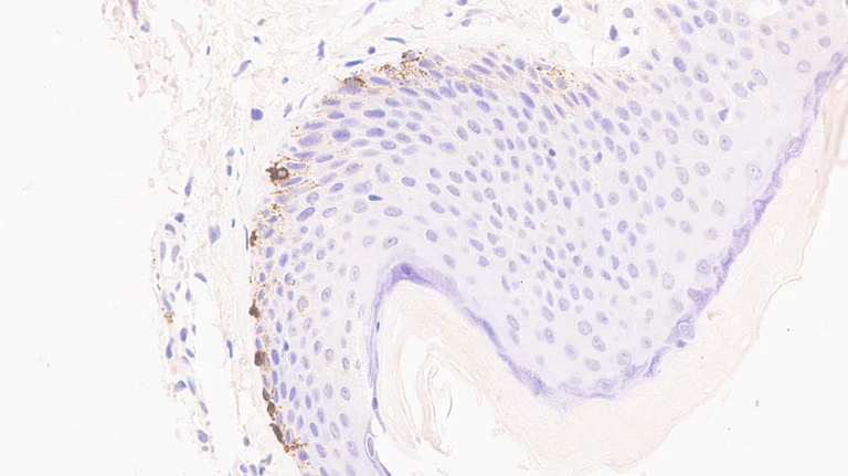Immunohistochemistry (Formalin/PFA-fixed paraffin-embedded sections) - Anti-Tyrosinase antibody [EPR10141] (AB170905)