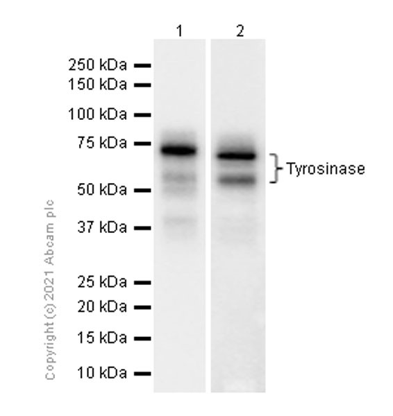 Western blot - Anti-Tyrosinase antibody [EPR10141] (AB170905), expandable thumbnail