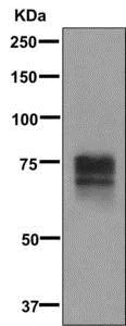 Western blot - Anti-Tyrosinase antibody [EPR10141] (AB170905)