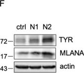 Western blot - Anti-Tyrosinase antibody [EPR10141] (ab170905), expandable thumbnail