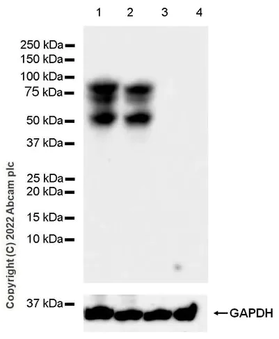 Western blot - Anti-Tyrosinase antibody [EPR10141] - BSA and Azide free (AB240163)