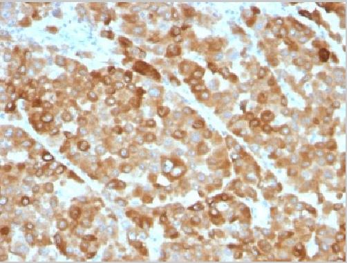 Immunohistochemistry (Formalin/PFA-fixed paraffin-embedded sections) - Anti-Tyrosinase antibody [OCA1/812] (AB216023), expandable thumbnail