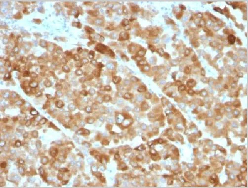 Immunohistochemistry (Formalin/PFA-fixed paraffin-embedded sections) - Anti-Tyrosinase antibody [OCA1/812] (AB216023)