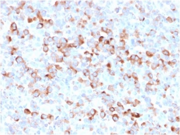 Immunohistochemistry (Formalin/PFA-fixed paraffin-embedded sections) - Anti-Tyrosinase antibody [rOCA1/812] (AB236496)