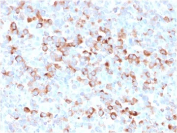 Immunohistochemistry (Formalin/PFA-fixed paraffin-embedded sections) - Anti-Tyrosinase antibody [rOCA1/812] (AB236496)