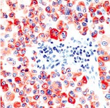 Immunohistochemistry (Formalin/PFA-fixed paraffin-embedded sections) - Anti-Tyrosinase antibody [SPM360], prediluted (AB54447)