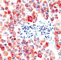 Immunohistochemistry (Formalin/PFA-fixed paraffin-embedded sections) - Anti-Tyrosinase antibody [SPM360], prediluted (AB54447)