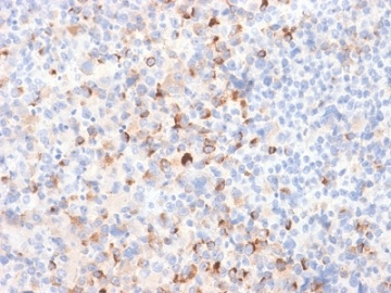 Immunohistochemistry (Formalin/PFA-fixed paraffin-embedded sections) - Anti-Tyrosinase antibody [TYR/2024R] (AB236495)