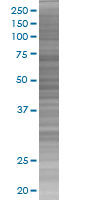 Tyrosinase overexpression 293T lysate (whole cell)