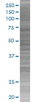 SDS-PAGE - Tyrosinase overexpression 293T lysate (whole cell) (AB94149)