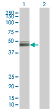 Western blot - Tyrosinase overexpression 293T lysate (whole cell) (AB94149)