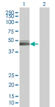 Western blot - Tyrosinase overexpression 293T lysate (whole cell) (AB94149)