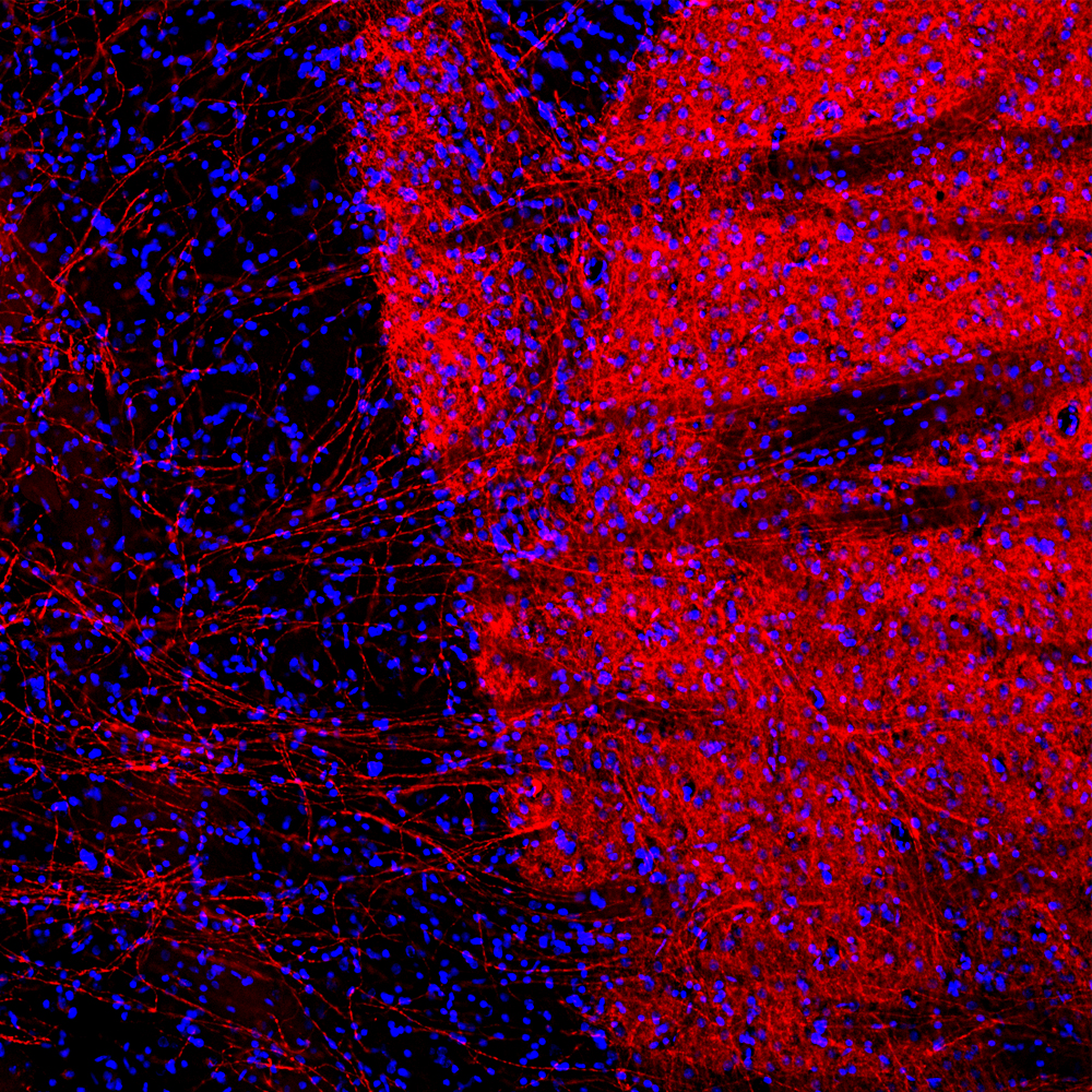 Immunohistochemistry (PFA perfusion fixed frozen sections) - Anti-Tyrosine Hydroxylase antibody [4H2] (AB315207), expandable thumbnail