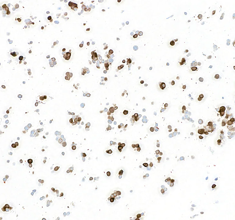 Immunocytochemistry - Anti-Tyrosine Hydroxylase antibody [BLR155J] - BSAfree (AB314080)
