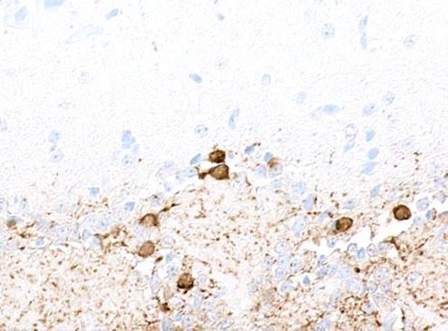 Immunohistochemistry (Formalin/PFA-fixed paraffin-embedded sections) - Anti-Tyrosine Hydroxylase antibody [BLR155J] - BSAfree (AB314080)