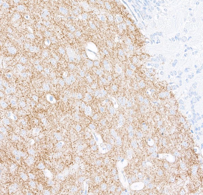 Immunohistochemistry (Formalin/PFA-fixed paraffin-embedded sections) - Anti-Tyrosine Hydroxylase antibody [BLR155J] - BSAfree (AB314080), expandable thumbnail