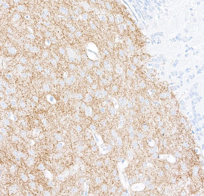 Immunohistochemistry (Formalin/PFA-fixed paraffin-embedded sections) - Anti-Tyrosine Hydroxylase antibody [BLR155J] - BSAfree (AB314080)