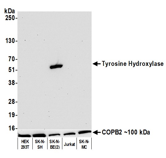 Western blot - Anti-Tyrosine Hydroxylase antibody [BLR155J] - BSAfree (AB314080), expandable thumbnail